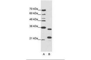 Image no. 1 for anti-AlkB, Alkylation Repair Homolog 8 (ALKBH8) (AA 141-190) antibody (ABIN1099945) (ALKBH8 anticorps  (AA 141-190))