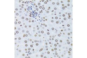 Immunohistochemistry of paraffin-embedded mouse liver using NFKB2 Antibody.