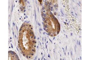 ABIN6266929 at 1/100 staining human Prostate tissue sections by IHC-P. (Anoctamin 7 anticorps  (Internal Region))