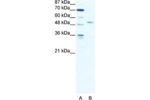 Western Blotting (WB) image for anti-Interferon Regulatory Factor 5 (IRF5) antibody (ABIN2461651) (IRF5 anticorps)