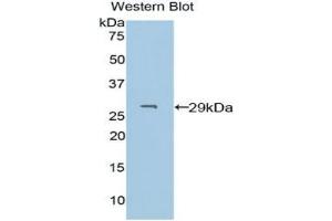 Detection of Recombinant PDXK, Human using Polyclonal Antibody to Pyridoxal Kinase (PDXK) (PDXK anticorps  (AA 29-253))
