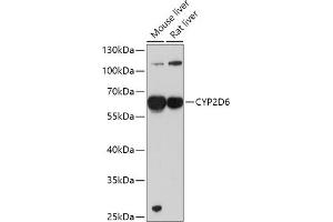 Western blot analysis of extracts of various cell lines, using CYP2D6 antibody (ABIN1512811, ABIN3021880, ABIN3021882 and ABIN6216807) at 1:1000 dilution. (CYP2D6 anticorps  (AA 20-230))