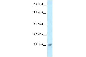 WB Suggested Anti-S100A8 Antibody Titration: 1. (S100A8 anticorps  (Middle Region))