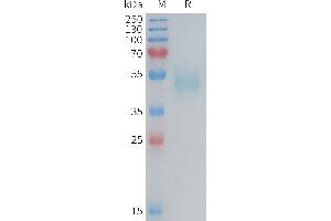 Mouse TSLP Protein, hFc Tag on SDS-PAGE under reducing condition.