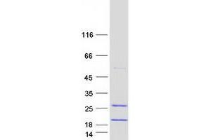 FAM103A1 Protein (Myc-DYKDDDDK Tag)
