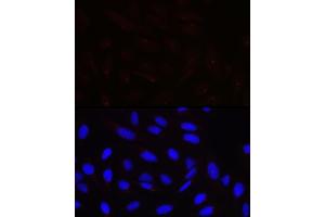 Immunofluorescence analysis of U-2 OS cells using PCNT Rabbit pAb (ABIN7269216) at dilution of 1:100 (40x lens). (PCNT anticorps)