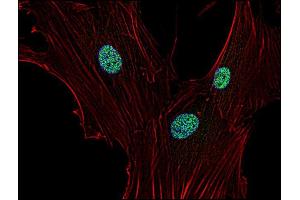Immunocytochemistry staining of p21 in human primary fibroblasts using anti-p21 (WA-1, green).