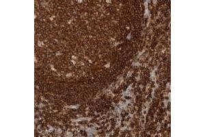 Immunohistochemical staining of human lymph node with RUNDC1 polyclonal antibody  shows strong cytoplasmic positivity in reaction center cells and lymphoid cells outside reaction centra at 1:20-1:50 dilution.