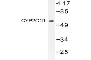 Western blot analysis of CYP2C19 antibody in extracts from 293 cells. (CYP2C19 anticorps)
