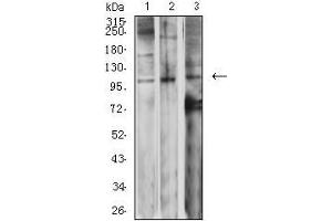 Western blot analysis using GRM2 mouse mAb against SK-N-SH (1), Jurkat (2), and SW620 (3) cell lysate. (GRM2 anticorps  (AA 414-558))