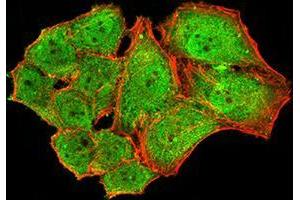 Immunofluorescence analysis of Hela cells using NS1 mouse mAb (green). (Parvovirus B19 NS1 (AA 1-216) anticorps)