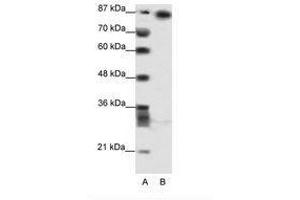 Image no. 1 for anti-Myoneurin (MYNN) (AA 281-330) antibody (ABIN202812) (Myoneurin anticorps  (AA 281-330))
