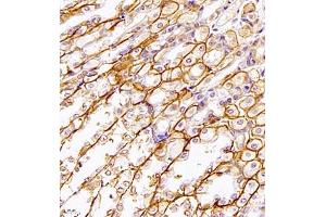 Immunohistochemistry of paraffin embedded mouse stomach using SLC7A8 (ABIN7074503) at dilution of 1:1100 (400x lens)
