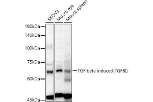 Western blot analysis of extracts of various cell lines, using TGF beta induced (TGFBI) antibody (ABIN6128864, ABIN6149078, ABIN6149080 and ABIN6215116) at 1:1000 dilution. (TGFBI anticorps  (AA 481-683))