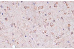 Immunohistochemistry of paraffin-embedded Mouse brain using CARTPT Polyclonal Antibody at dilution of 1:100 (40x lens). (CARTPT anticorps)
