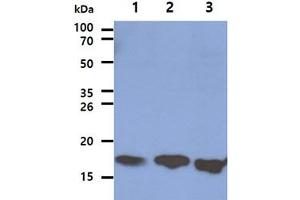 The Cell lysates (40ug) were resolved by SDS-PAGE, transferred to PVDF membrane and probed with anti-human LSM5 antibody (1:1000). (LSM5 anticorps)