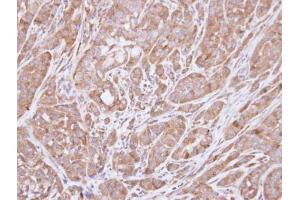 IHC-P Image Immunohistochemical analysis of paraffin-embedded A549 xenograft , using HSD3B2, antibody at 1:100 dilution. (HSD3B2 anticorps)