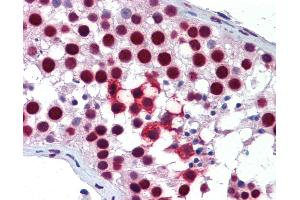 Anti-SAM68 antibody IHC of human testis.
