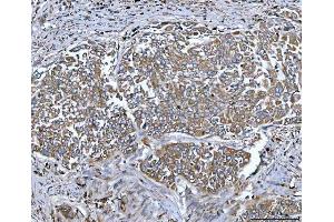 IHC analysis of Tripeptidyl peptidase II/TPPII/TPP2 using anti-Tripeptidyl peptidase II/TPPII/TPP2 antibody (ABIN7601293).