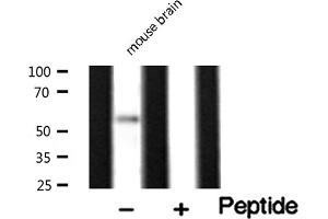 Western blot analysis of Peripherin expression in Mouse brain lysate