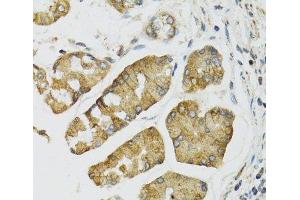 Immunohistochemistry of paraffin-embedded Human esophagus using PI3 Polyclonal Antibody at dilution of 1:100 (40x lens). (PI3 anticorps)