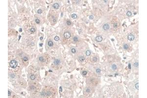 DAB staining on IHC-P; Samples: Human Liver Tissue