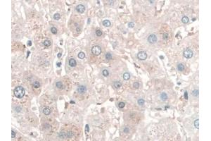 DAB staining on IHC-P; Samples: Human Liver Tissue (SPAG1 anticorps  (AA 1-365))