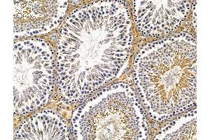 anti-KN Motif and Ankyrin Repeat Domains 4 (KANK4) antibody