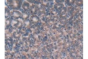 Detection of GR in Mouse Stomach Tissue using Polyclonal Antibody to Glutathione Reductase (GR)