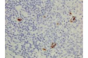 Immunohistochemical staining (Formalin-fixed paraffin-embedded sections) of human lymphoid tissue with Human IgG3 monoclonal antibody, clone RM119 (Biotin) . (Lapin anti-Humain IgG3 Anticorps (Biotin))