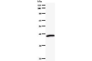 Western Blotting (WB) image for anti-Protein Arginine Methyltransferase 2 (PRMT2) antibody (ABIN931133) (PRMT2 anticorps)
