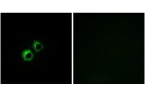 Immunofluorescence analysis of MCF7 cells, using MRPS21 Antibody.