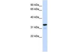 Image no. 1 for anti-Nuclear Factor of kappa Light Polypeptide Gene Enhancer in B-Cells Inhibitor, alpha (NFKBIA) (C-Term) antibody (ABIN6744364) (NFKBIA anticorps  (C-Term))