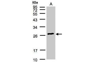 WB Image Sample(30 μg of whole cell lysate) A:Hep G2, 12% SDS PAGE antibody diluted at 1:3000