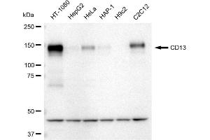 Western blotting analysis using CD13 antibody (ABIN7797548).