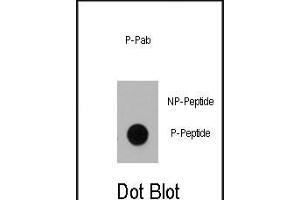 Dot blot analysis of anti-Dnmt1 Phospho-specific Pab (ABIN389901 and ABIN2839739) on nitrocellulose membrane.