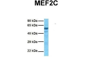 Host:  Rabbit  Target Name:  MEF2C  Sample Tissue:  Human Fetal Brain  Antibody Dilution:  1. (MEF2C anticorps  (N-Term))