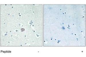 Immunohistochemistry analysis of paraffin-embedded human brain tissue using ADORA2A polyclonal antibody . (Adenosine A2a Receptor anticorps)