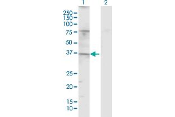 TAS2R20 anticorps  (AA 1-309)