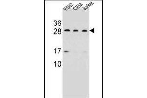 CD79A Antibody (C-term) (ABIN656983 and ABIN2846166) western blot analysis in K562,CEM,Jurkat cell line lysates (35 μg/lane).