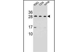 CD79A Antibody (C-term) (ABIN656983 and ABIN2846166) western blot analysis in K562,CEM,Jurkat cell line lysates (35 μg/lane). (CD79a anticorps  (C-Term))