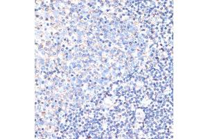 Immunohistochemistry of paraffin-embedded human tonsil using CD44 antibody (ABIN3021912, ABIN3021913, ABIN3021914 and ABIN6217536) at dilution of 1:200 (40x lens).