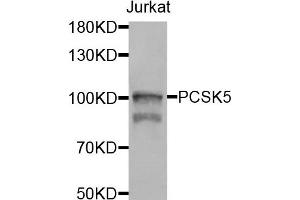 Western blot analysis of extracts of jurkat cells, using PCSK5 antibody. (PCSK5 anticorps)
