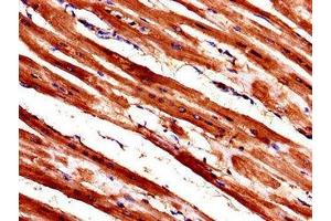 Immunohistochemistry of paraffin-embedded human heart tissue using ABIN7175846 at dilution of 1:100