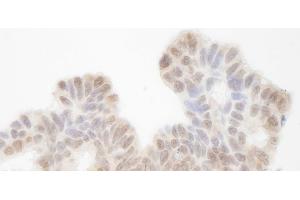Immunohistochemistry (IHC) image for anti-SIN3 homolog A, transcription regulator (SIN3A) (AA 1-50) antibody (ABIN7448796) (SIN3A anticorps  (AA 1-50))