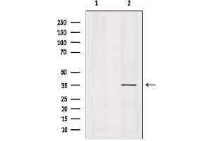 Western blot analysis of extracts from rat brain, using OR51A1P Antibody. (OR51A1P anticorps)