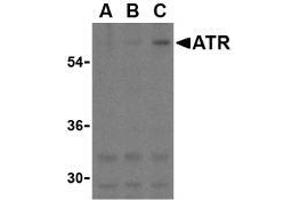 Western blot analysis of ATR in K562 cell lysates with this product atR antibody at (A) 0. (ANTXR1 anticorps  (C-Term))