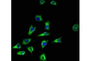 Immunofluorescence staining of A549 cells with ABIN7169583 at 1:100, counter-stained with DAPI. (CD164 anticorps  (AA 24-162))