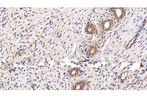 Detection of CD147 in Rat Uterus Tissue using Polyclonal Antibody to Cluster Of Differentiation 147 (CD147)