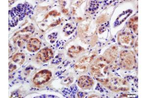Formalin-fixed and paraffin embedded human kidney labeled with Anti-CYP2D6 Polyclonal Antibody, Unconjugated (ABIN682558) at 1:200 followed by conjugation to the secondary antibody and DAB staining
